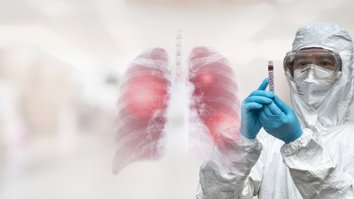 Genetic Signatures Ltd (ASX:GSS) Covid-19