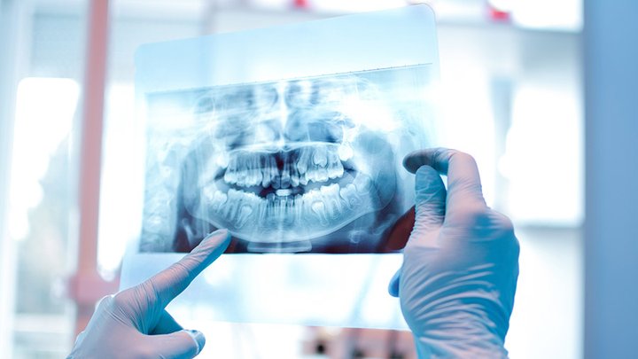 Impression healthcare