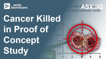 IIQ: Exosomes successfully weaponised - cancer cells located and killed in proof of concept study