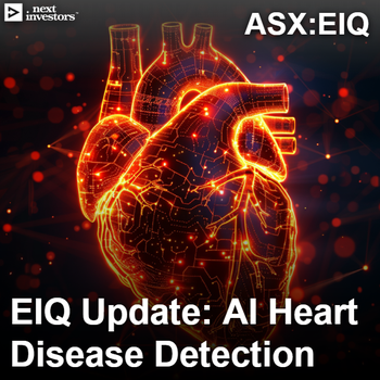 Broad update from EIQ highlights potential for AI-heart disease detection software