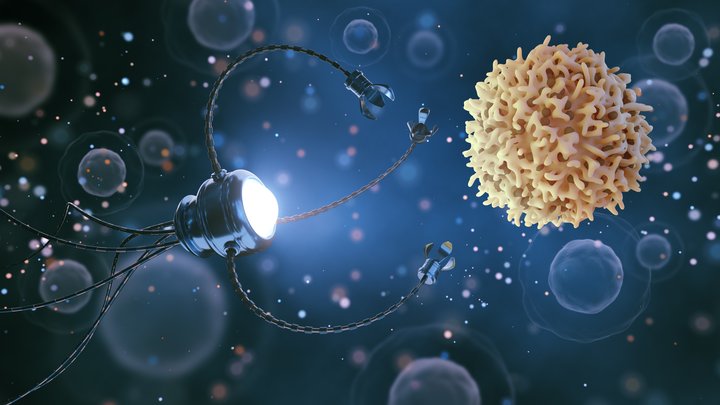 cancer daignostics.jpeg